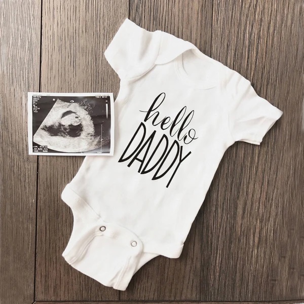 Baby Clothing Online - Mùa Hè Sơ Sinh Trẻ Sơ